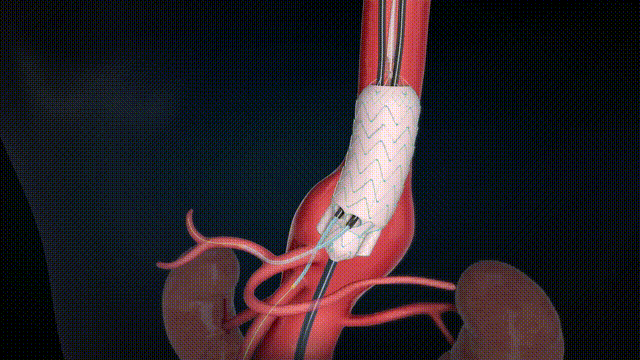 G-Branch ֧+ͷţɫĻ20s2024.10.11 00_00_00-00_00_30.gif